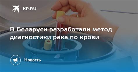 Современные методы диагностики рака крови