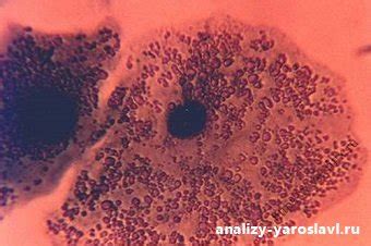 Специфика исследования на рост ureaplasma spp