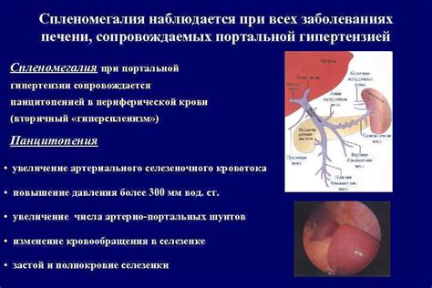 Спленомегалия: причины, симптомы, лечение