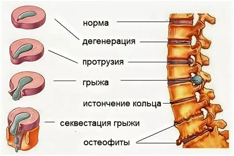 Способы диагностики боли под ребрами сбоку