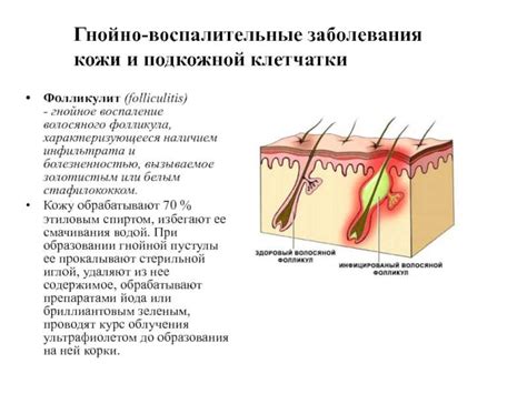 Способы лечения выросших фолликулов