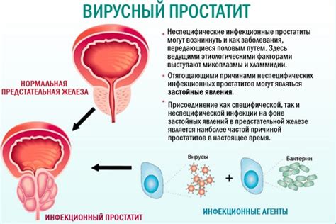 Способы лечения порушки-парани