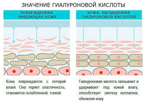 Способы применения гиалуроновой кислоты