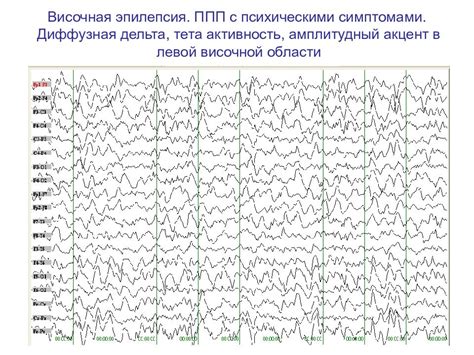 Сравнение электроэнцефалографии с другими способами исследования мозга