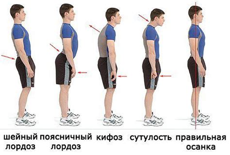 Стоячая поза: как сохранить правильную осанку