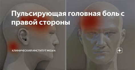 Стреляющая боль в правой части головы