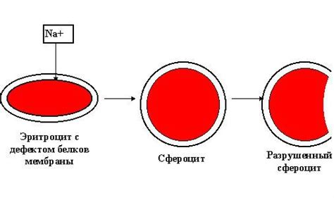 Сфероцитоз: особенности и причины