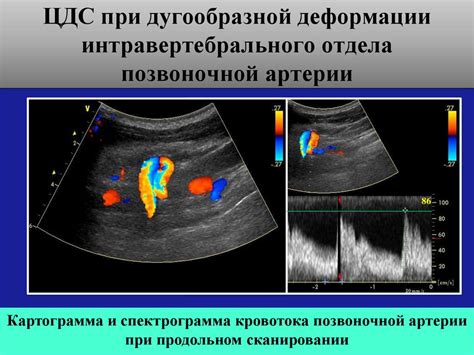 С образная деформация вса с обеих сторон: причины и диагностика