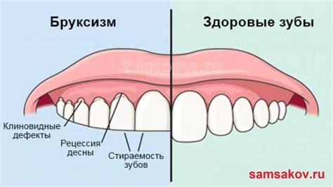 Таинственное явление: покачивание зубов во время сна