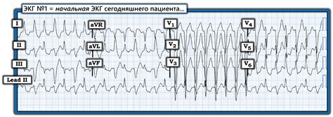 Техника электрофизиологии