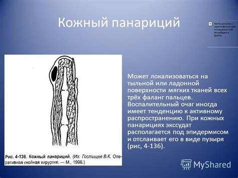 Типичные для покровительства операции