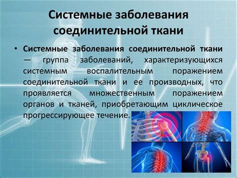 Типичные симптомы системных заболеваний