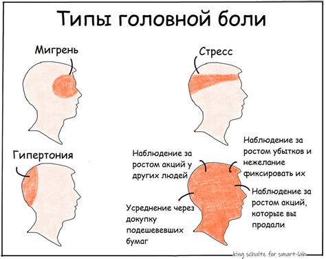 Типы опухолей, вызывающих корешковые боли положения