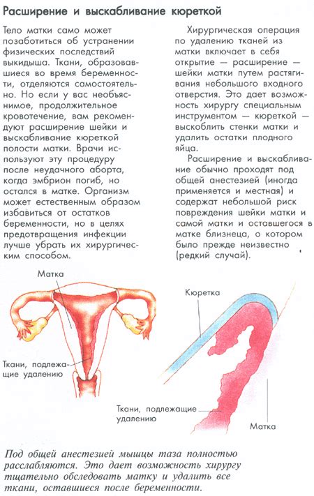 Травма матки