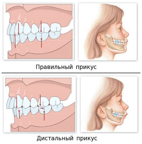 Травма челюсти