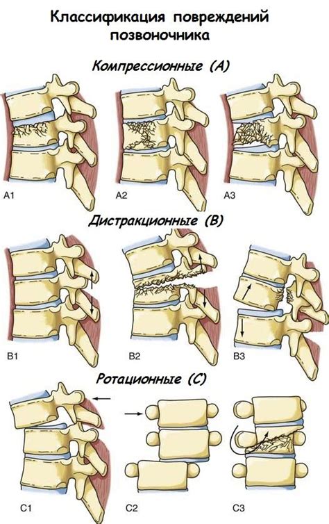 Травмы позвоночника