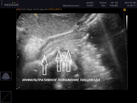 УЗИ желудка: основной метод исследования