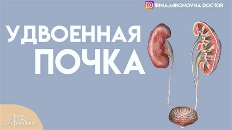 Удвоенная почка у взрослого - симптомы и лечение