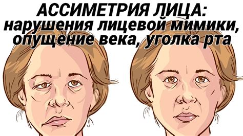 Улыбка в сторону левого уголка рта