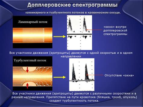 Ультразвуковые методы раскрытия зуба