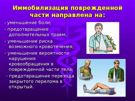 Уменьшение риска повреждений