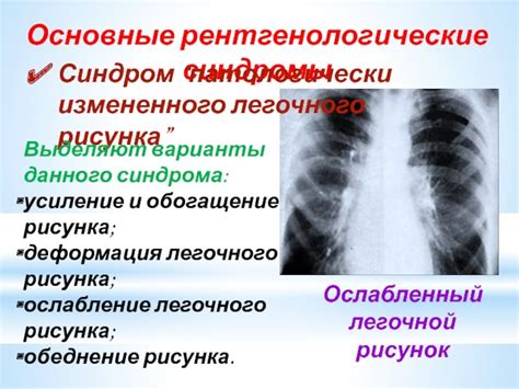 Умеренная деформация легочного рисунка