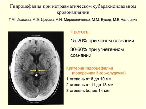 Умеренное расширение субарахноидального пространства