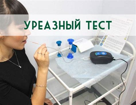 Уреазный тест: основные преимущества