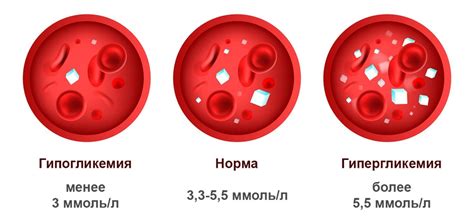 Уровень глюкозы в крови у мужчин