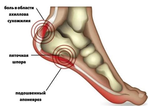 Устранение жировика с помощью хирургии: эффективный метод борьбы с жировыми образованиями