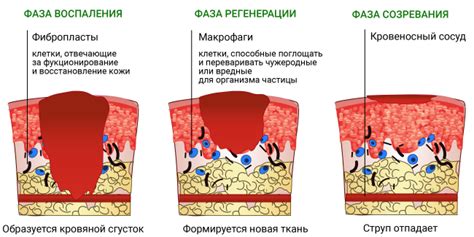 Фазы ожога и их особенности