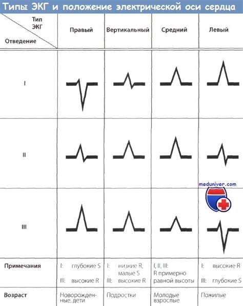 Факторы, влияющие на ЭКГ в вертикальном положении ЭОС у подростков