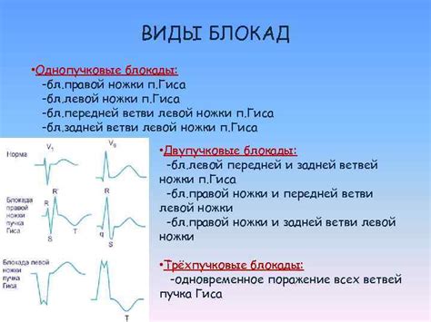 Факторы риска для развития блокады передне-верхней ветви левой ножки пучка Гиса