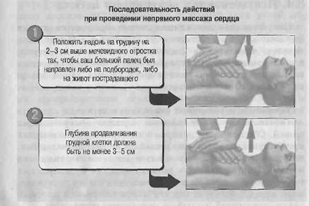 Факторы риска прекардиального удара