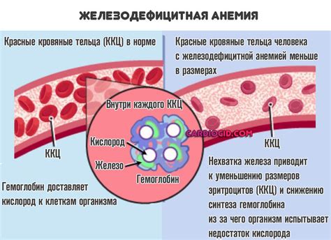 Ферритин 159: что это значит?