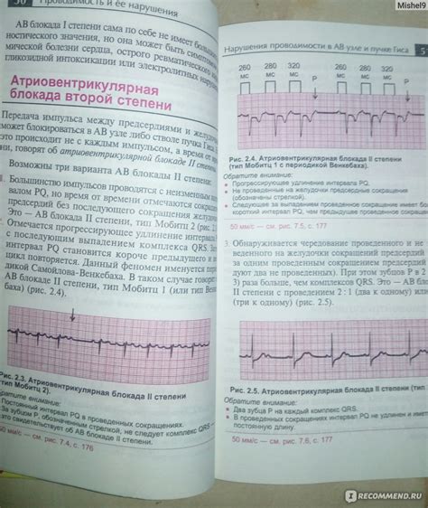 Физиологические основы кардиограммы