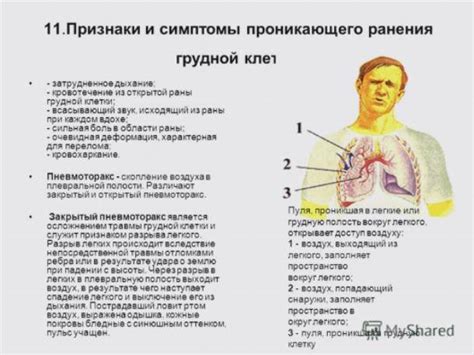 Физиологические причины возникновения кашля при сильном вдохе