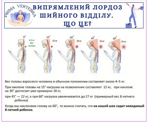 Физиологический шейный лордоз