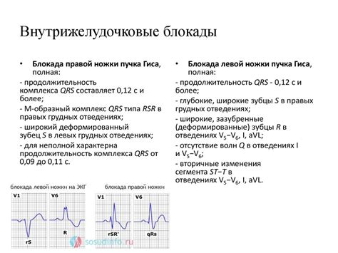 Физиология внутрижелудочкового проведения