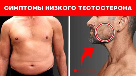 Физические проявления низкого уровня тестостерона