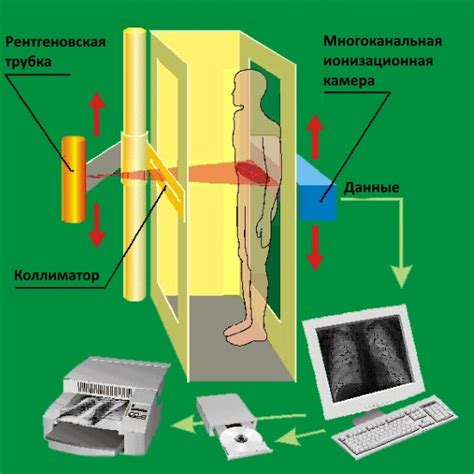 Флюорография МЗВ: сущность и принцип работы