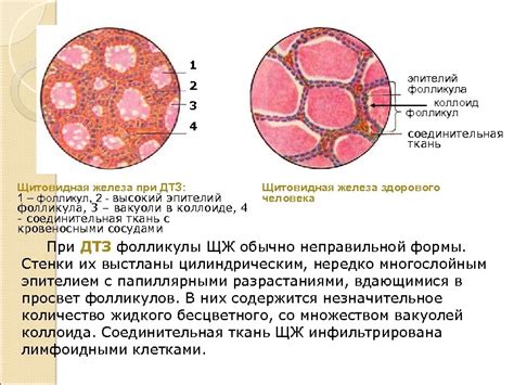 Фолликулярная эпителия: что это такое и почему она важна