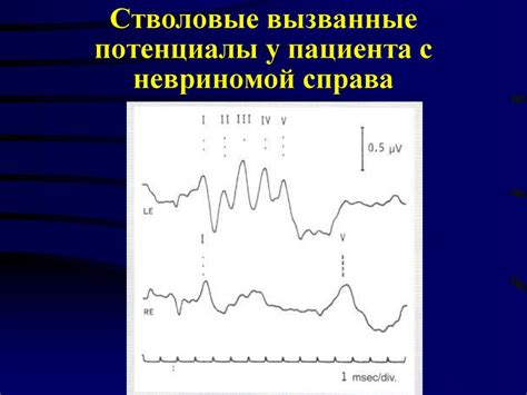 Фотографии тела с выявленной невриномой