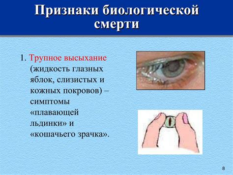 Функции кошачьего зрачка: отличительные черты в анатомическом плане