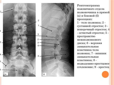 Функциональные пробы при рентгене грудного отдела позвоночника