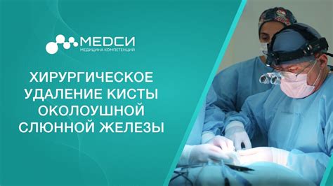 Хирургическое удаление кисты