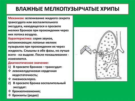 Хрипы мелкопузырчатые - общая информация