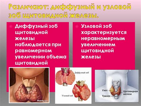 Хронические заболевания щитовидной железы