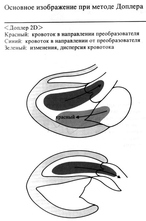 Цветное допплеровское картирование