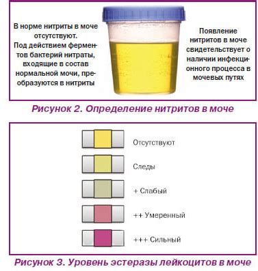 Цвет растяжек: отражение состояния здоровья